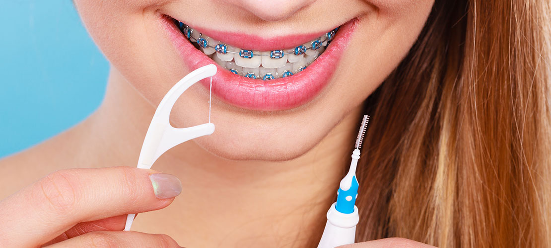 Alternative Ways to Floss your Teeth
