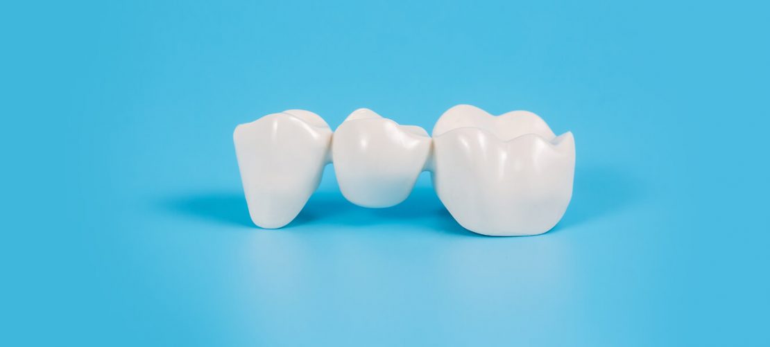 How to take care of Dental Crowns