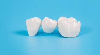 How to take care of Dental Crowns